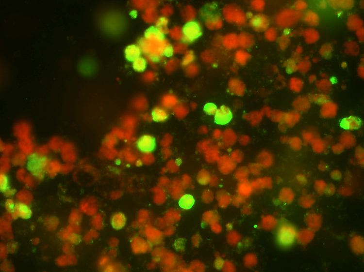 Die "Immunfluorenz-Methode" lässt gesunde Zellen rot erscheinen. Die mit dem Schweinegrippen-Virus infizierten Zellen strahlen grün. Damit kann zweifelsfrei eine Infizierung festgestellt werden.
