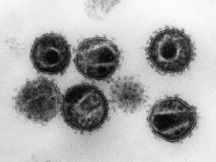 Elektronenmikroskopische Aufnahme mehrerer HIV (Humane Immunschwäche-Viren), Erreger der Immunschwäche-Krankheit Aids.
