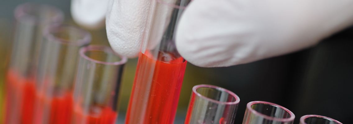 PID: Diagnose zur Früherkennung schwerer Erbschäden.