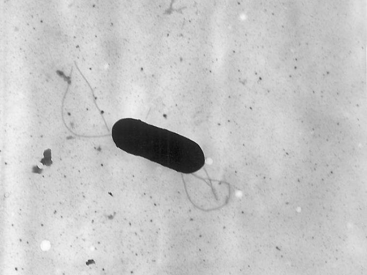 Listeria monocytogenes, einer der häufigsten Erreger für Listeriose.jpg