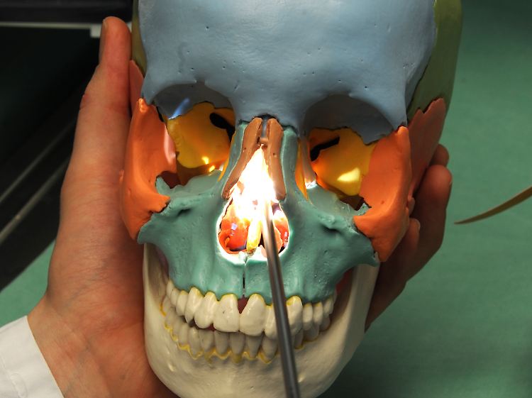 Ein Phantomschädel zur Ausbildung von Chirurgen.