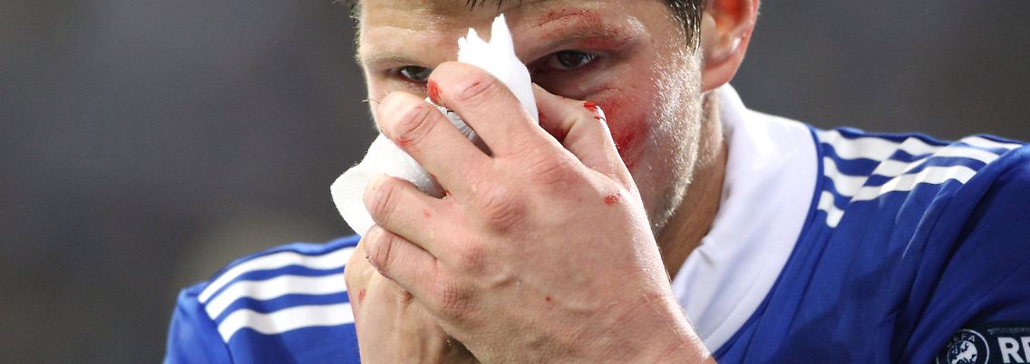 Das tut ernsthaft weh: Klaas-Jan Huntelaar bei der Nullnummer der Schalker gegen Larnaka.