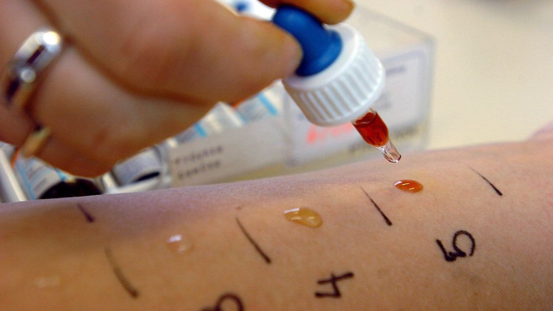 Experten raten von IgG-Tests ab.