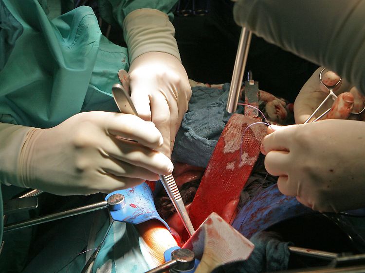 Auch wenn die Zahl der Organspender allmählich steigt, sind die zur Verfügung stehenden Organe längst nicht ausreichend.