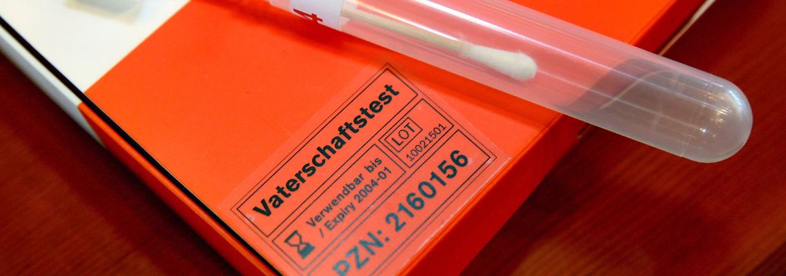 Ein Abstrich genügt, dann herrscht Gewissheit.