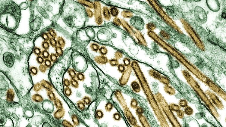 Die Erreger der Vogelgrippe-Virus H5N1 sind in der Aufnahme durch ein elektronisches Mikroskop braun dargestellt.