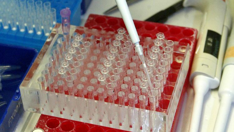 Untersuchungen auf H5N1-Viren im Labor.
