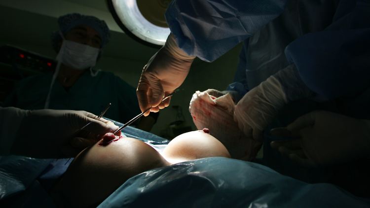 Mittlerweile gibt es 20 offiziell registrierte Krebsfälle bei Frauen, denen PIP-Brustimplantate eingesetzt wurden.