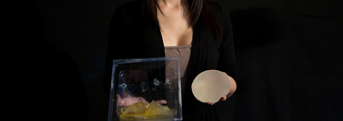 Rita de Martino zeigt die Billig-Implantate, die sie sich aus der Brust entfernen lassen musste. In der rechten Hand hat sie ein intaktes Implantat. Im Februar 2011 platzte das Implantat in ihrer linken Brust.