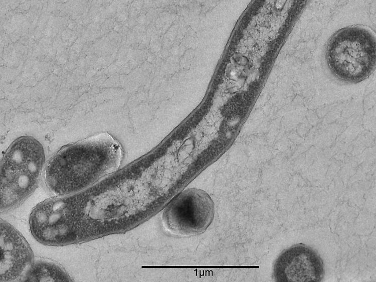 Tuberkulose-Erreger haben in den Filtersystemen der Flugzeuge kaum eine Chance.
