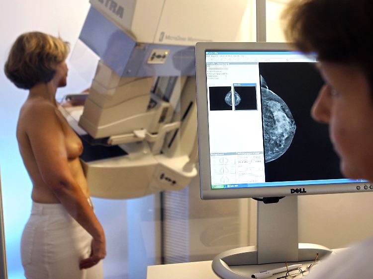 Ein Mammografie-Screening.