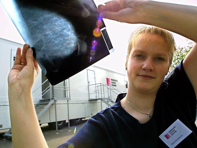 Mammografie-Bild aus einer mobilen Praxis.