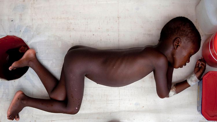 Cholera ist vor allem für Kinder und ältere Menschen sehr gefährlich.