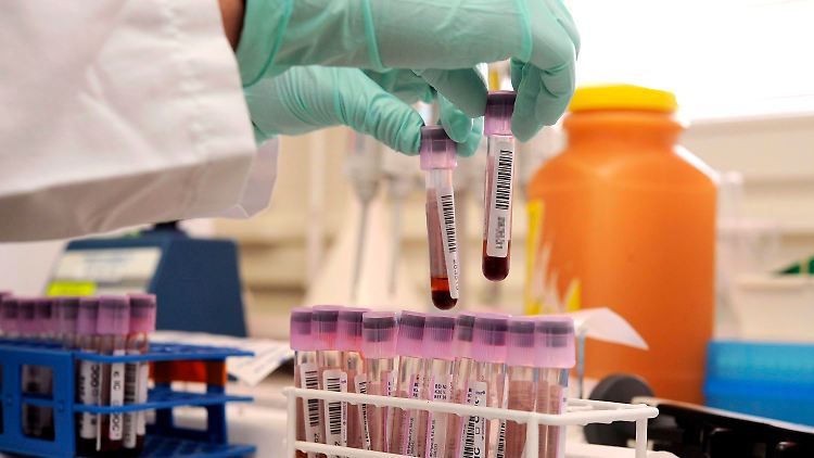 Das Blut wird im Labor getestet.