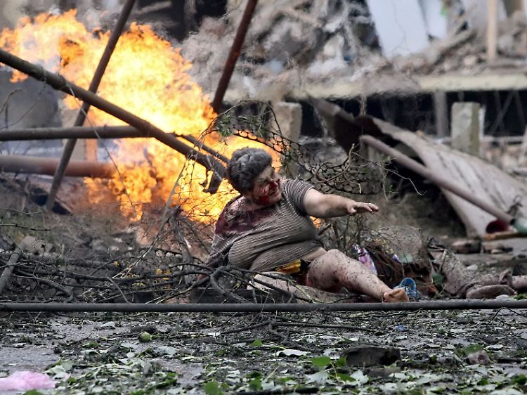 Dieses Bild ging im August 2008 um die Welt. Es zeigt eine schwerverletzte georgische Frau in Gori nach einem Bombenangriff russischer Flugzeuge.