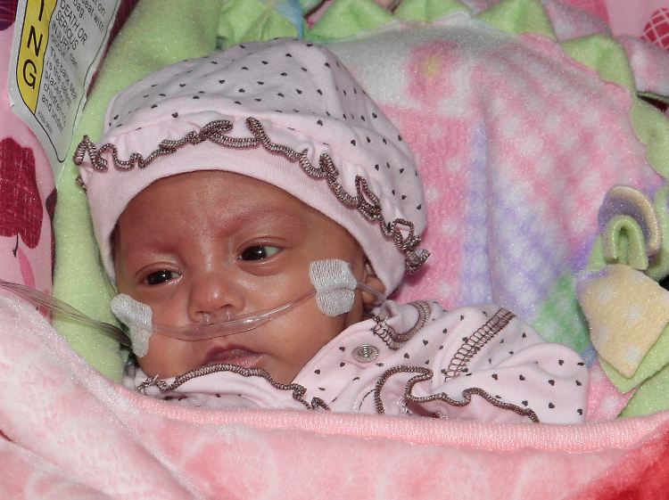 Bei den Anzeichen einer Meningokokken-Infektion gehört das Baby sofort zum Arzt.