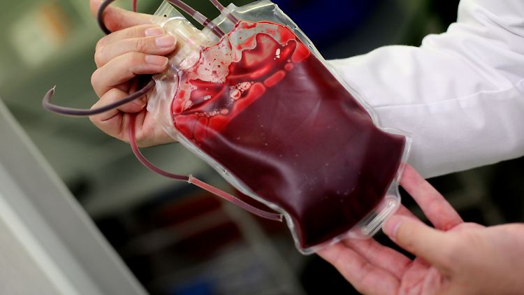 Fällt UV-bestrahltes Blut unter Doping?