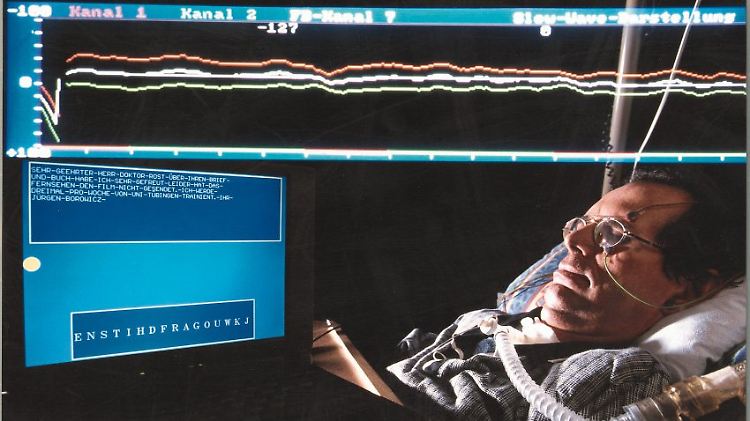 Mit dem Foto "Kommunikation via Hirnströme", das einen Mann zeigt, der an einen Apparat zur Messung der Hirnströme angeschlossen ist, gewann der Hamburger Fotograf Marc Steinmetz im Jahr 2008 den zweiten Preis (Einzelfoto) beim Fotowettbewerb "Wissenschaft visuell" der Zeitschrift "bild der wissenschaft".