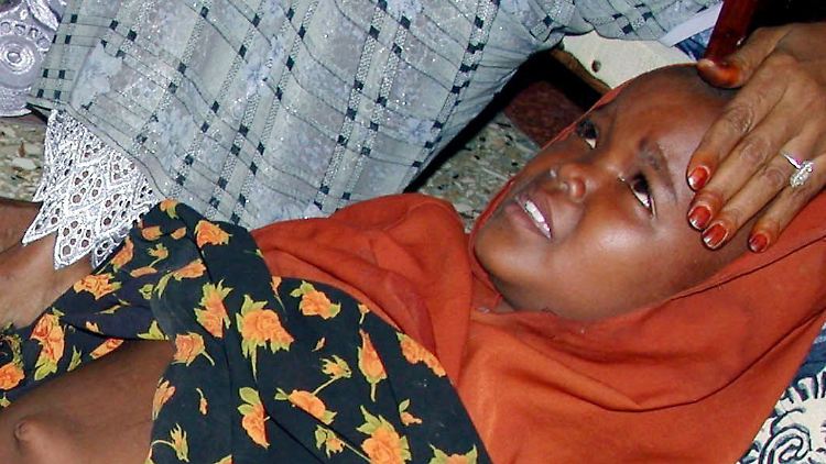 Beschneidung ohne Narkose: Wie diesem Mädchen aus Somalia ergeht es weltweit rund drei Millionen Mädchen im Jahr.