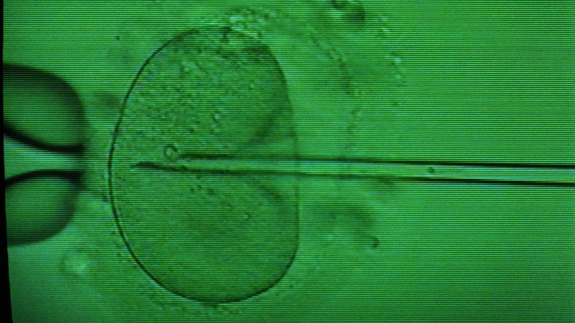 Beim sogenannten "Retortenbaby-Verfahren" werden Samenzelle unter dem Mikroskop mittels Mikropipette in eine Eizelle eingebracht.