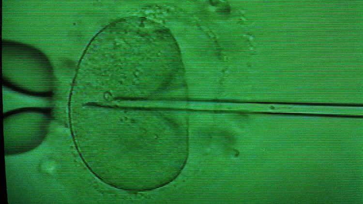Einbringen einer Samenzelle in eine Eizelle mittels Mikropipette unter dem Mikroskop beim sogenannten "Retortenbaby-Verfahren" (In-vitro-Fertilisation).