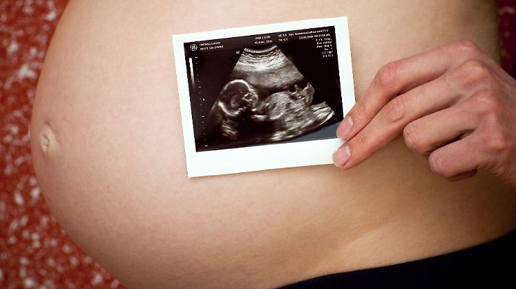 Eine Schwangere hält das Ultraschallbildes ihres ungeborenen Kindes vor ihren Bauch.