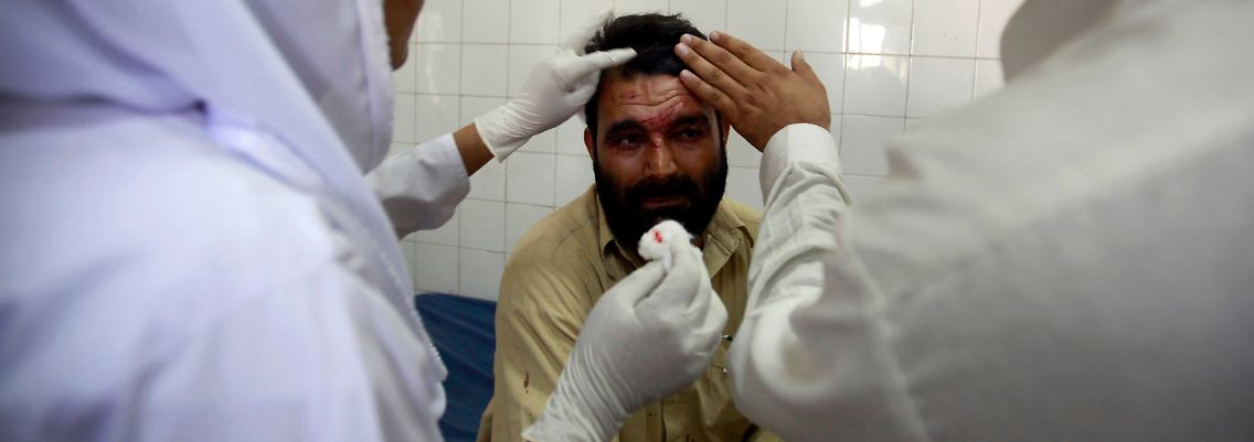 Dieser Mann wurde verletzt, als eine Autobombe in Peshawar explodierte.