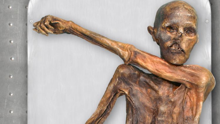Ötzi litt an einer Herz-Kreislauf-Erkrankung - bisher als moderne Zivilisationskrankheit eingestuft.
