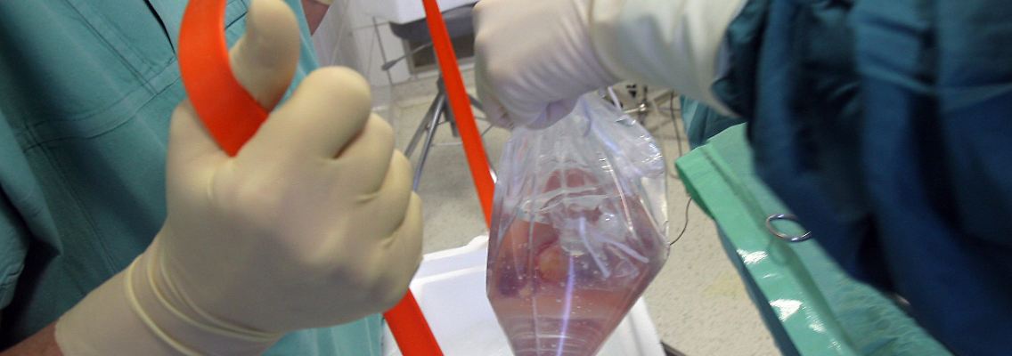 Am Universitätsklinikum Jena wird einem Spender eine Niere entnommen, die für eine Transplantation vorgesehen ist.
