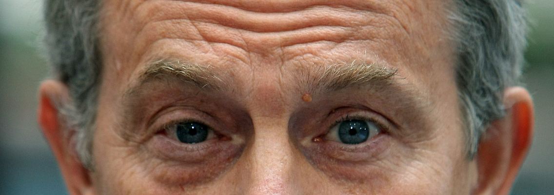 Die Umfrage dürfte bei Blair für Stirnrunzeln sorgen.