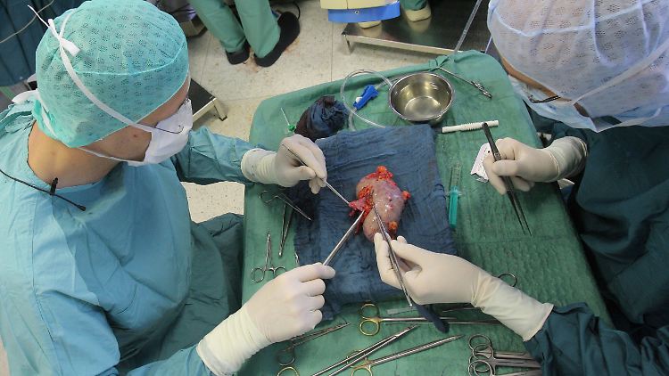 Mediziner bereiten eine Niere für die Transplantation vor.