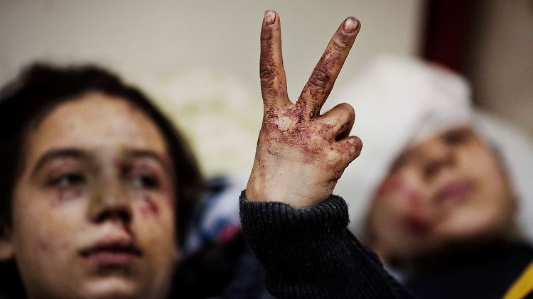 Die 12-jährige Hana zeigt das Victory-Zeichen. Sie wurde wie ihre 13-jährige Schwester bei einem Raketeneinschlag in Idlib verletzt.