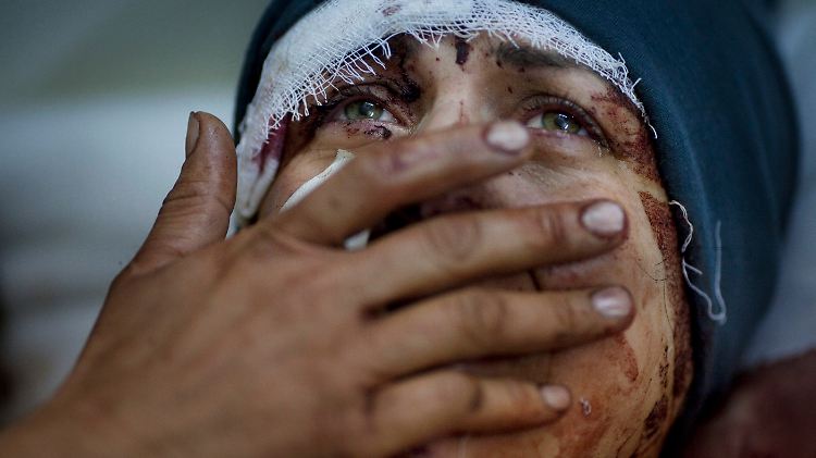 Eine verletzte Frau in der umkämpften Stadt Idlib im Norden des Landes.