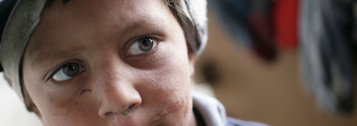 Viele Kinder im Kosovo leben "am Rande der Gesellschaft" heißt es in der Studie von Unicef.