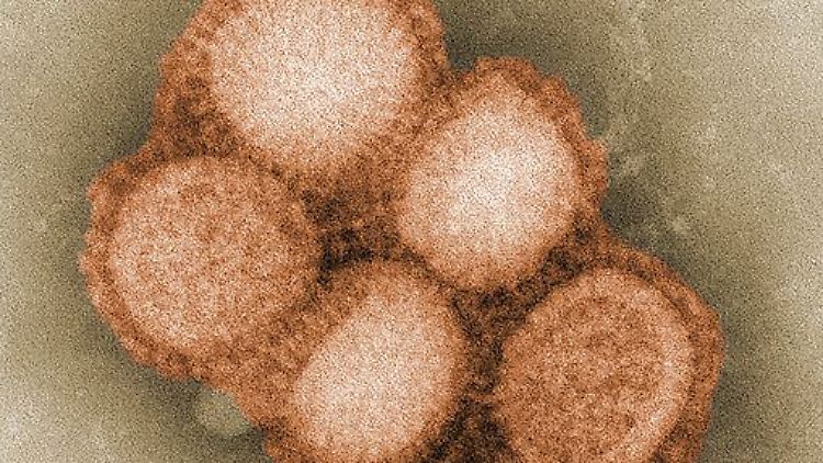 Das menschliche Immunsystem reagiert auf die Strukturen an der Oberfläche der Schweinegrippe-Viren.