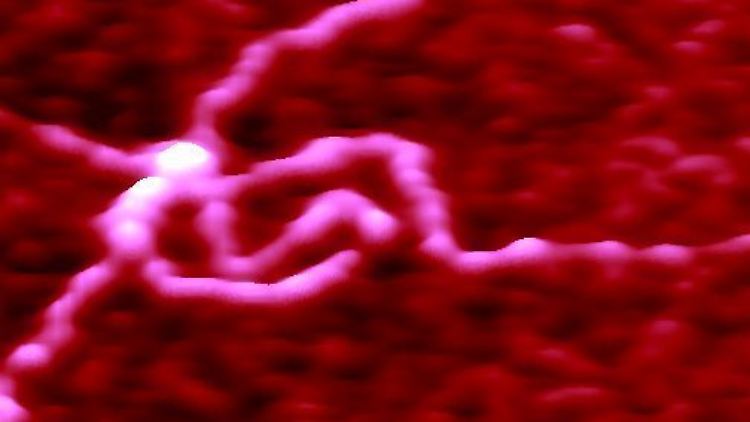 Sich kreuzende DNS-Stränge, aufgenommen mit einem Rasterkraft-Mikroskop. Bei der Untersuchung zum Miller-Syndrom zeigten sich in einem DNA-Abschnitt gehäuft Fehler.