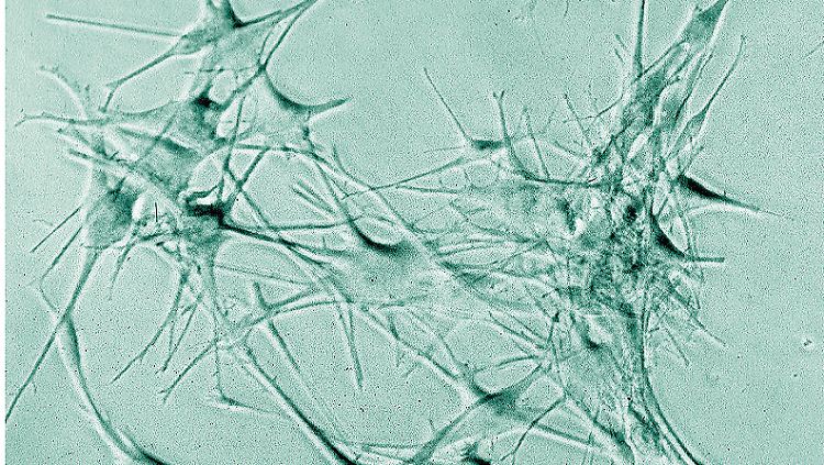 Ohne sie geht's nicht: Dendritische Zellen sind Teil des Immunsystems. Sie erkennen Fremdkörper und geben eine entsprechende Botschaft an die Killerzellen weiter.