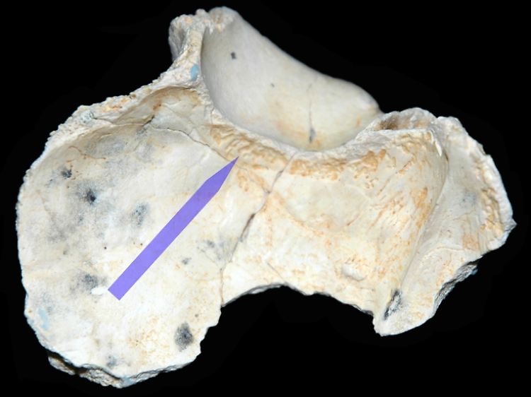 Der Pfeil auf dem undatierten Foto zeigt auf Einkerbungen und Riefen an der Innenseite des Schädels eines Homo erectus.