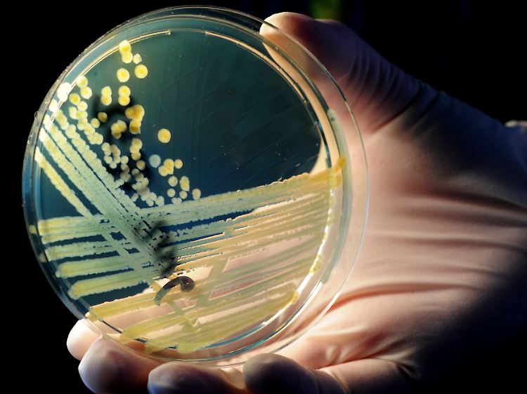 Eine Kombination aus körpereigenen Stoffen und Antibiotika soll E.coli-Keime besser bekämpfen.