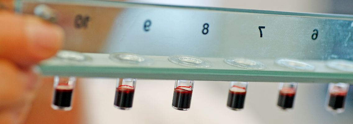 Mit der Tablette sind weder Injektionen noch regelmäßige Kontrollen des Blutbilds erforderlich. Außerdem entfallen Dosisanpassungen im Hinblick auf Alter, Körpergewicht und Geschlecht der Patienten.