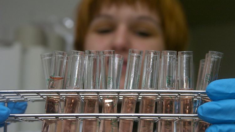 Medikamententests sollen die Aidsforschung voranbringen. Einen Impfstoff gegen die Immunschwäche gibt es nicht.