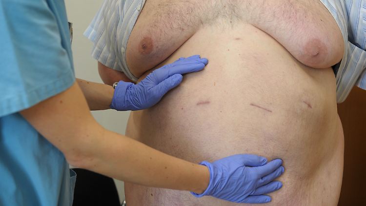 Allein in Hamburg hat sich die Zahl extrem übergewichtiger Patienten seit 2004 verzwanzigfacht.