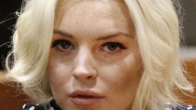 Verletzt, aber nicht schwer: Lindsay Lohan.