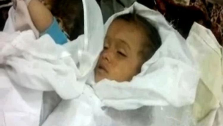 Immer mehr Kinder sterben in Syrien.