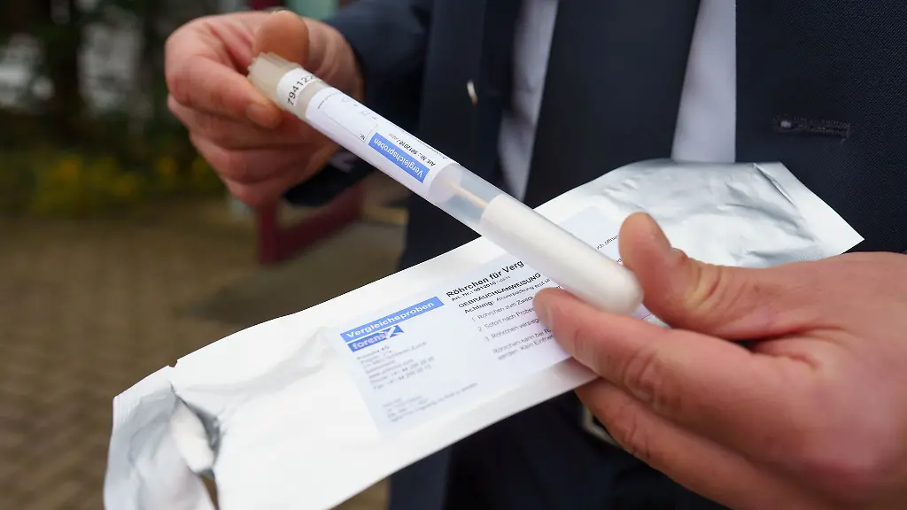 Die-Polizei-entnimmt-auch-freiwillige-Speichelproben