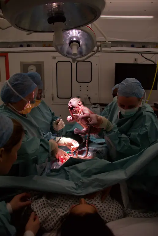 Cesarian-the-moment-of-birth3