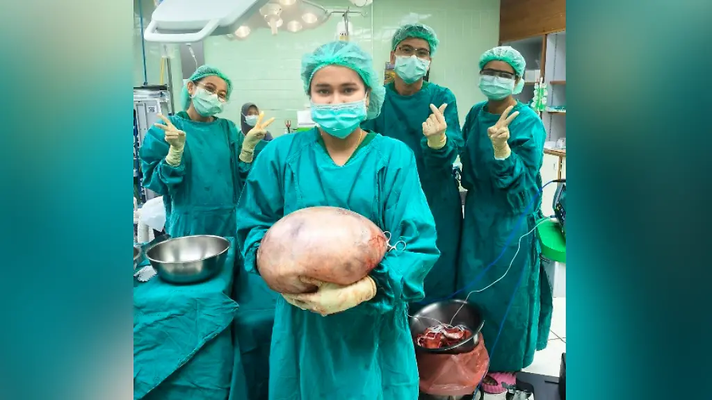 Aerzte-mit-massiver-Eierstockzyste