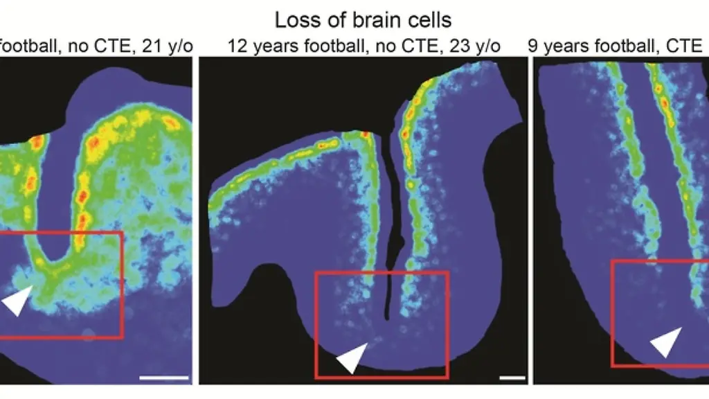 VERWENDUNG-NUR-IN-ZUSAMMENHANG-MIT-DER-STUDIE