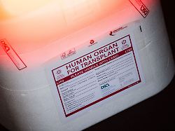 Spendenzahl wieder gestiegen: Organe bleiben in Deutschland 