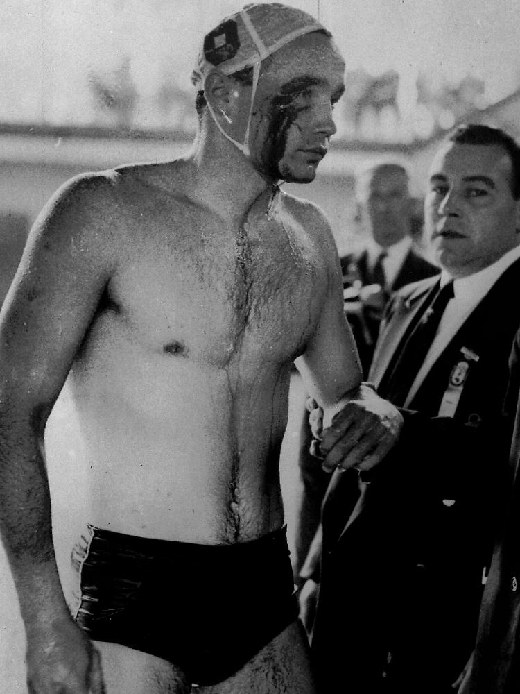 Gezeichnet: Der Ungar Ervin Zador trug 1956 eine klaffende Wunde vom Duell mit der Sowjetunion davon - aber am Ende auch Olympia-Gold.